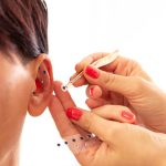 Therapist applying several Auriculotherapy Magnetic Ear Patches on patient ear